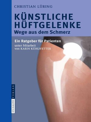 cover image of Künstliche Hüftgelenke